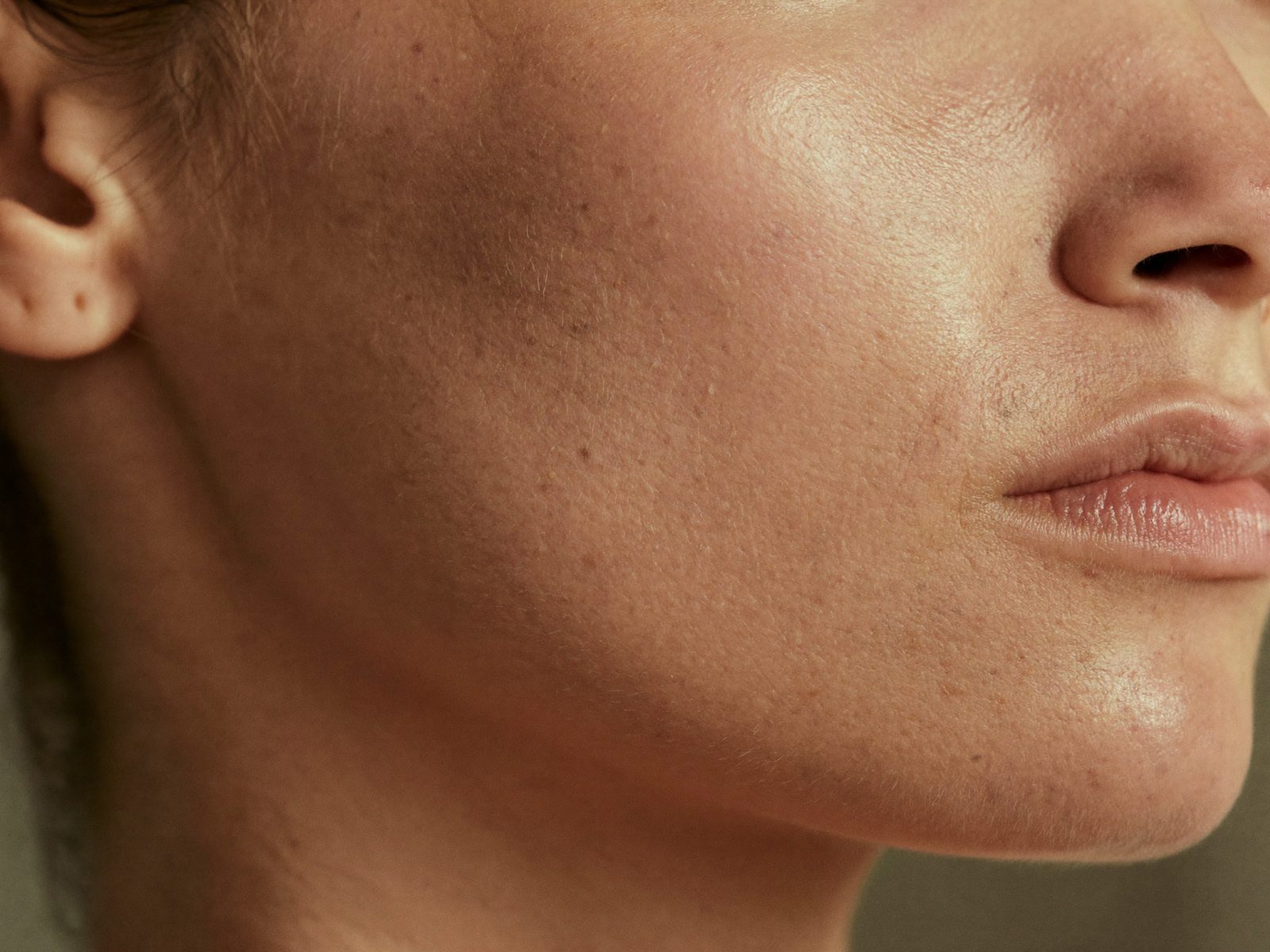 Skinboosters